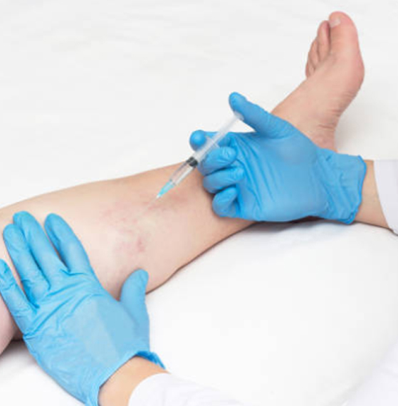 Angiólogos Ciudad de México